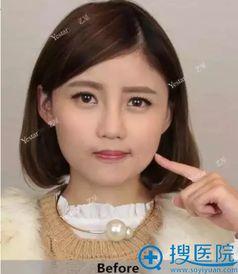 武汉明星整容,揭秘美丽背后的秘密