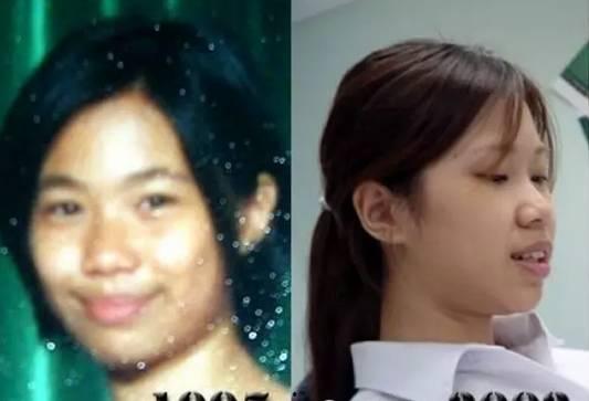 中国哪个网红整容,揭秘中国某网红整容前后对比